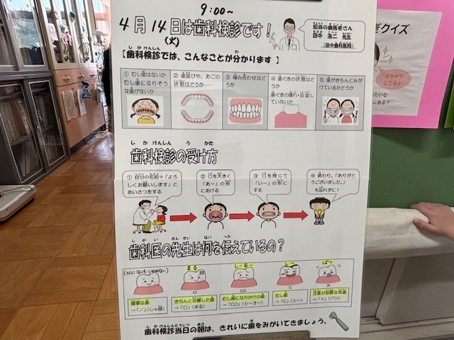 歯科検診の方法